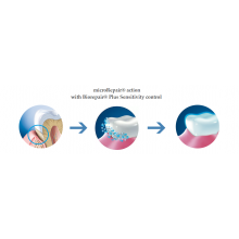 sensitive teeth repair